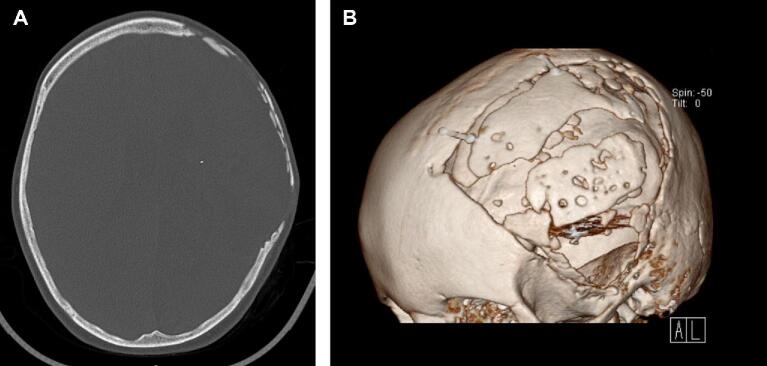 FIGURE 1.