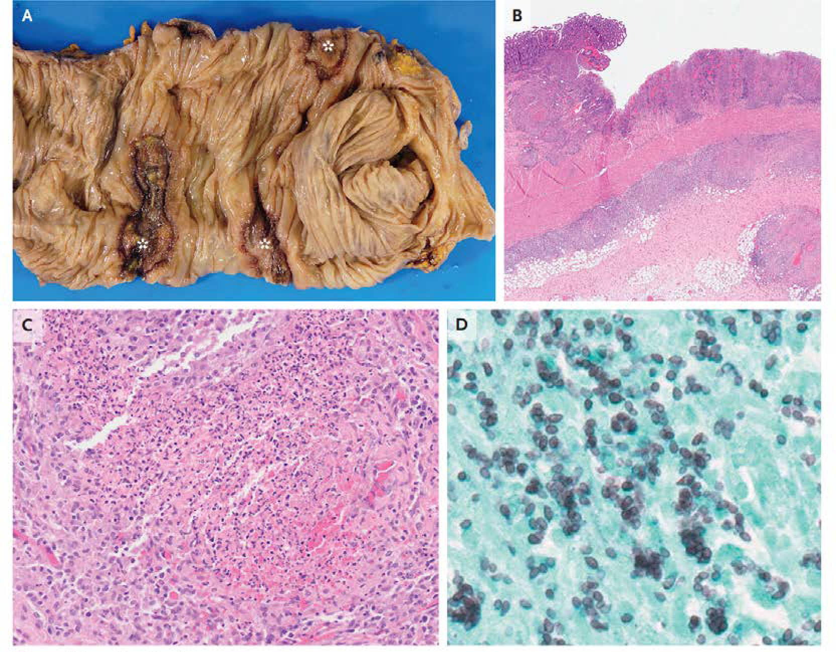 Figure 4: