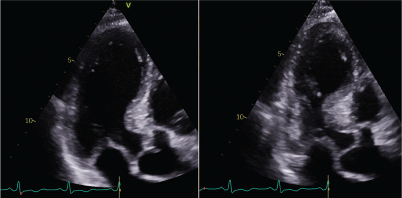 FIGURE 4