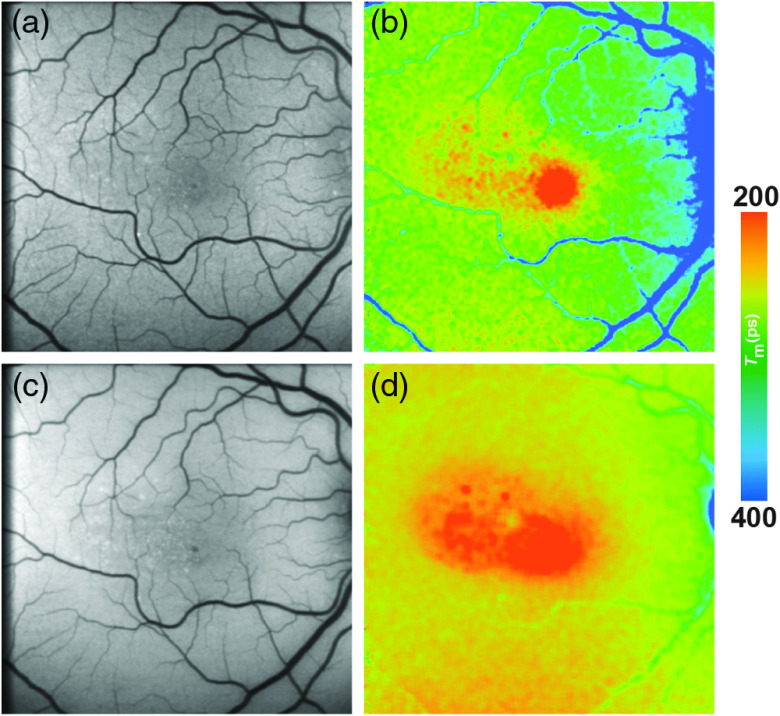 Fig. 11