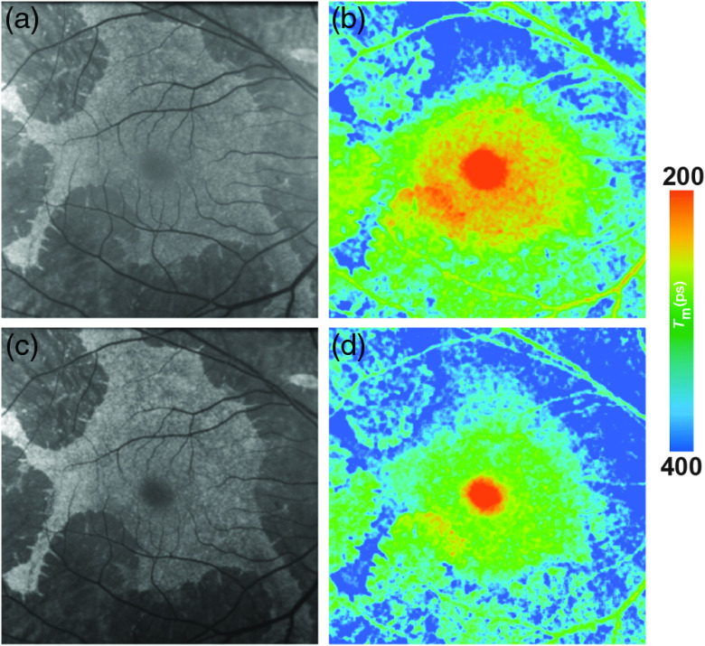 Fig. 12