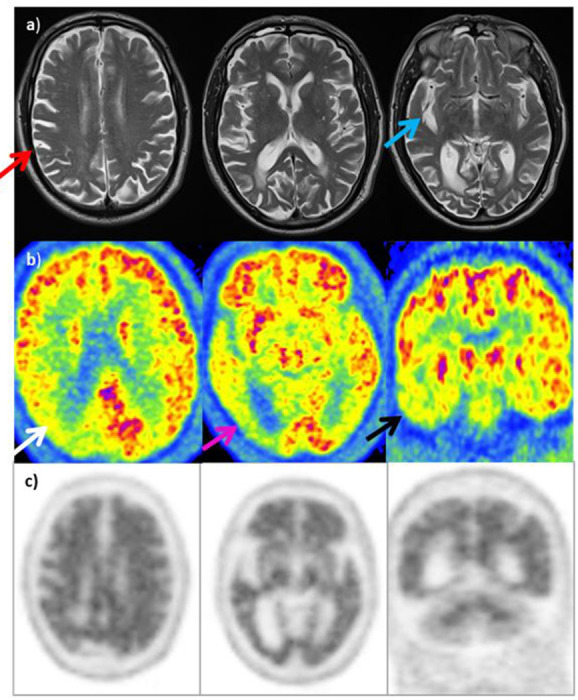 Figure 11. 