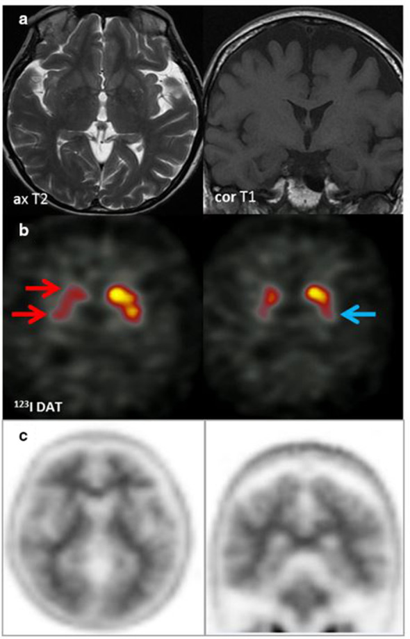 Figure 12. 