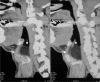 Fig. 1a, b, c, d.