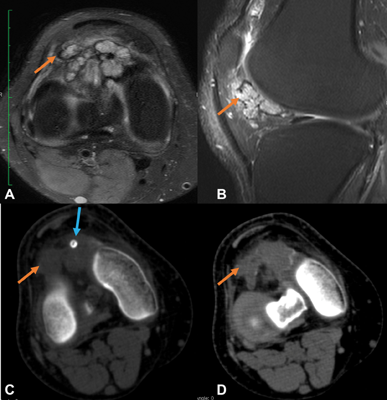 Fig. 18