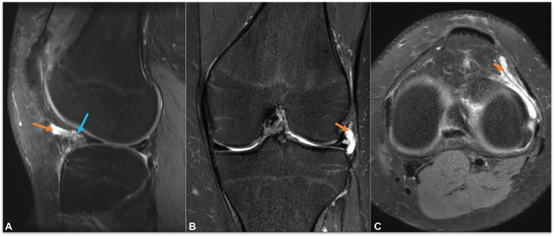 Fig. 10