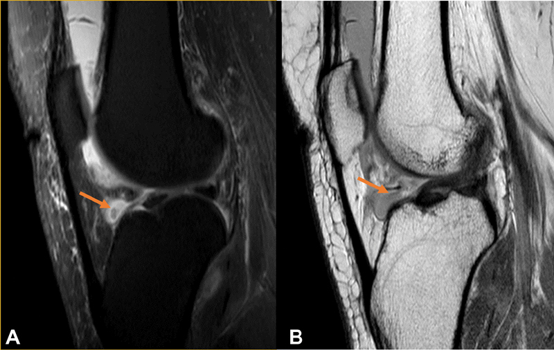 Fig. 11