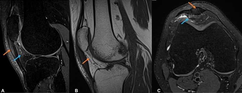 Fig. 9