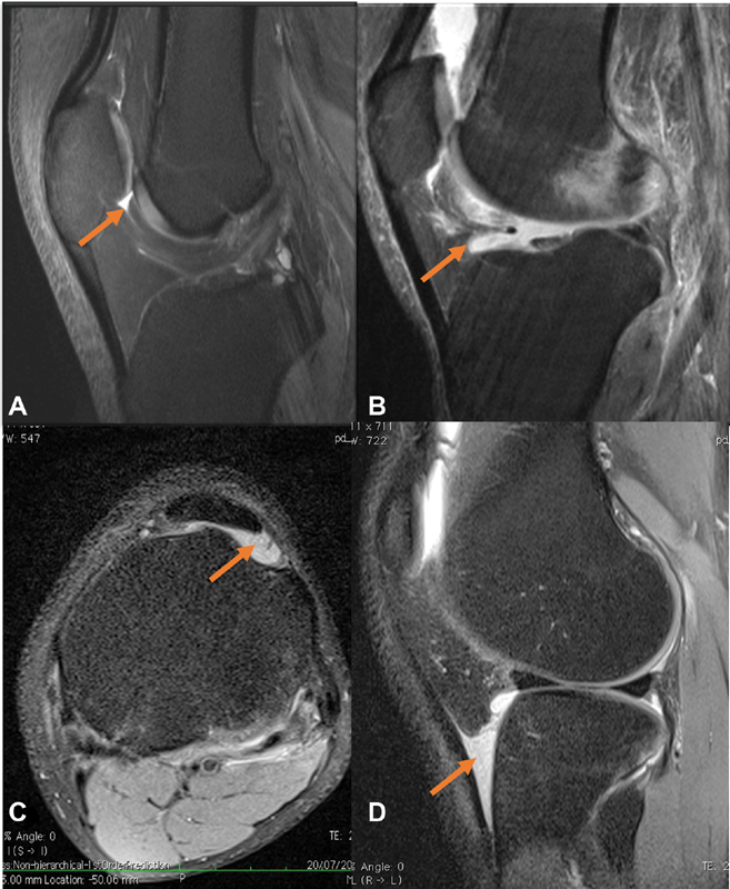 Fig. 24