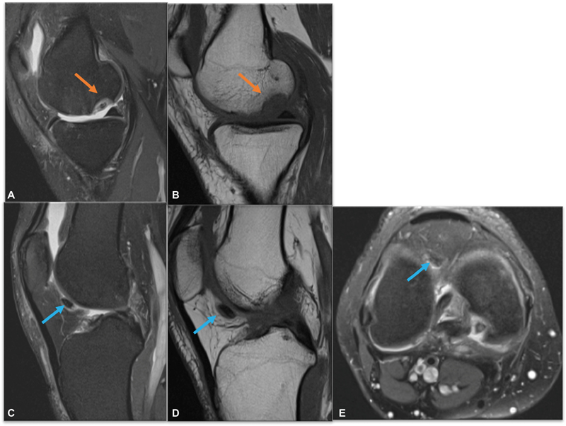 Fig. 12