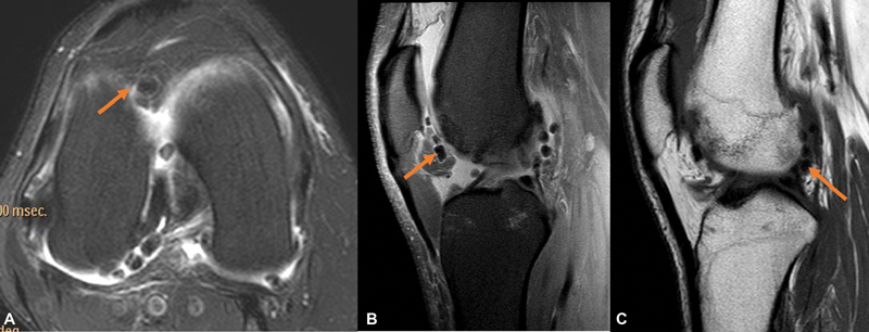 Fig. 19