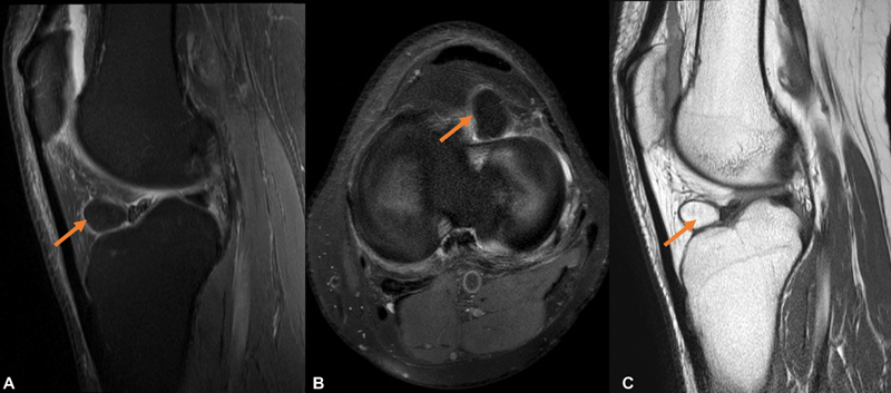 Fig. 16