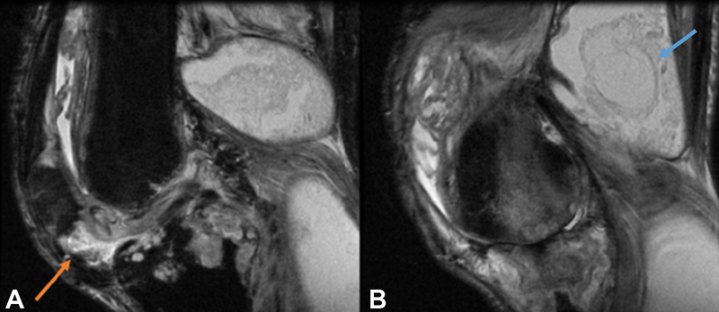 Fig. 23