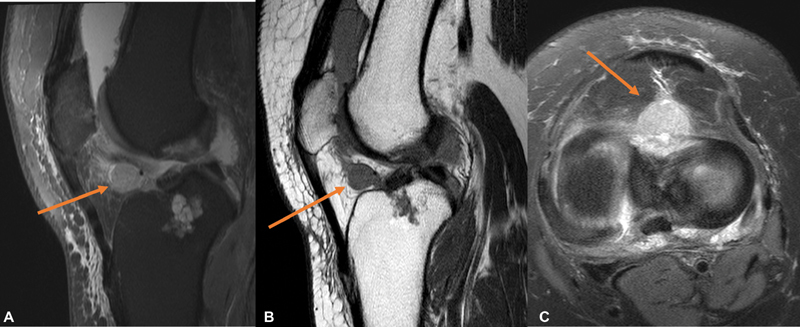 Fig. 17