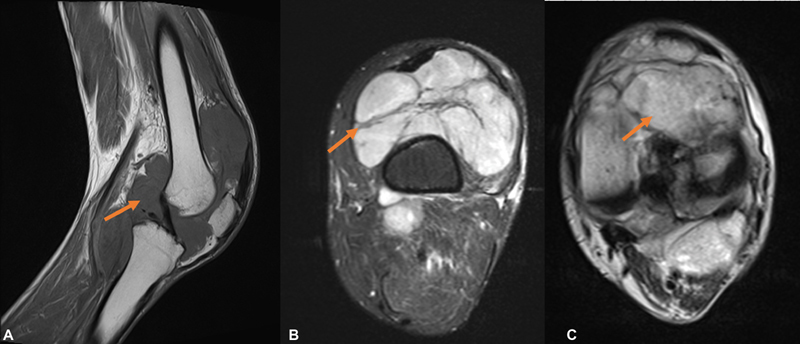 Fig. 20