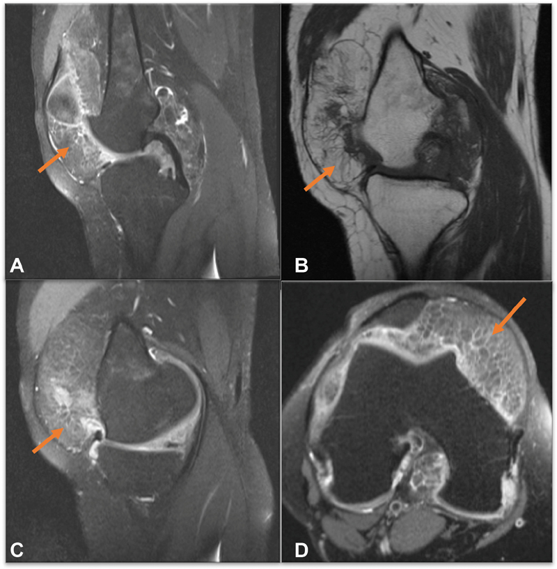 Fig. 22