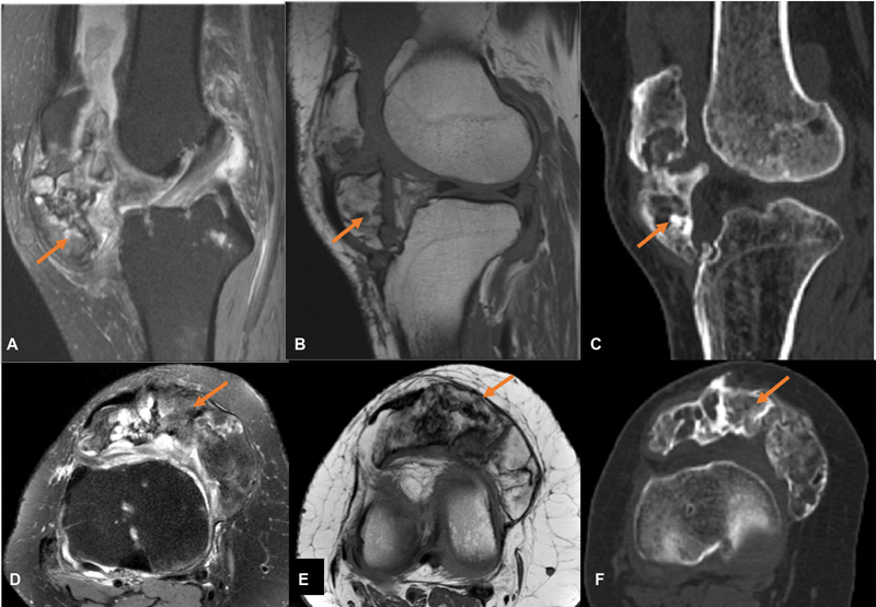 Fig. 21