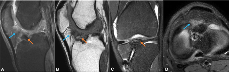 Fig. 14