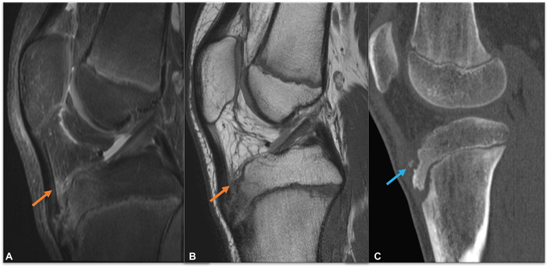 Fig. 15