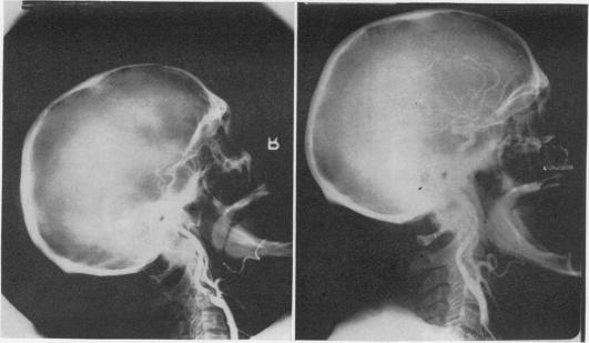 Fig. 1A (left), 1B (right).