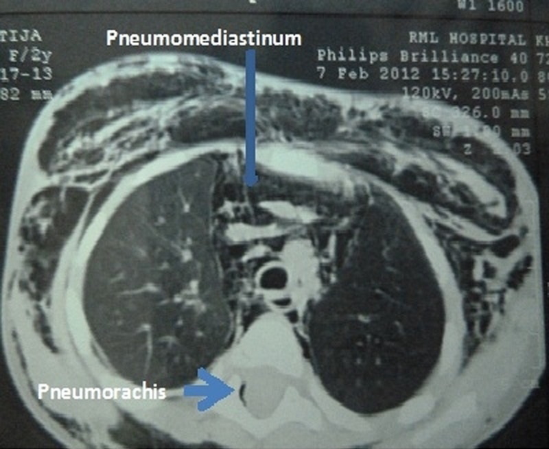 Figure 3