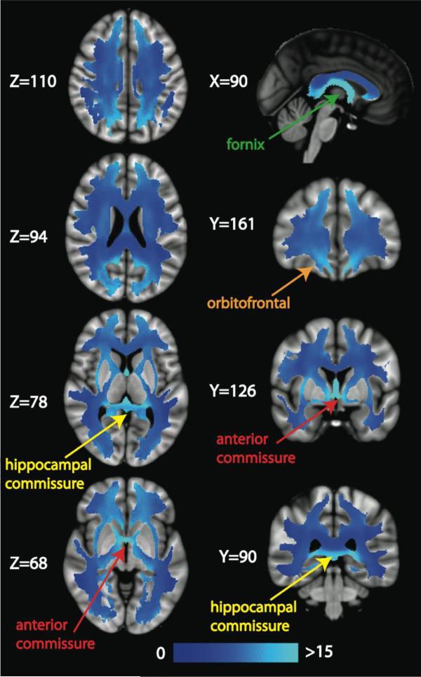 Figure 13