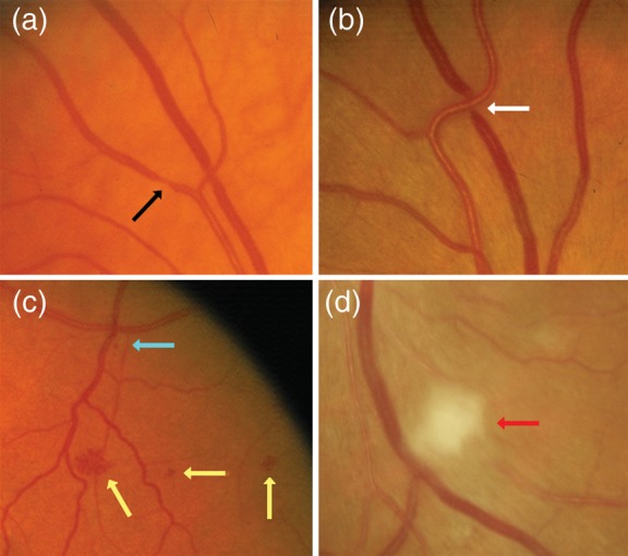 Figure 6