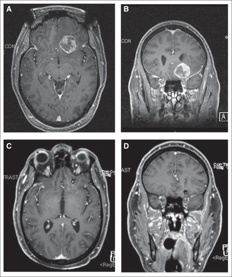 Fig 1.