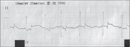 Figure-3