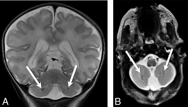 Fig 3.