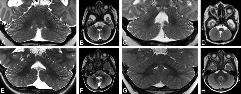 Fig 7.