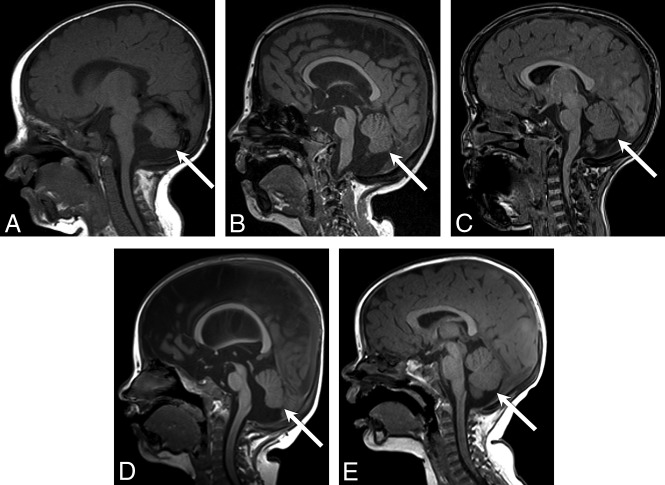 Fig 6.