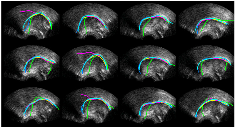 Figure 12