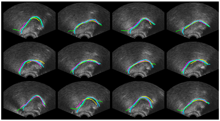 Figure 11