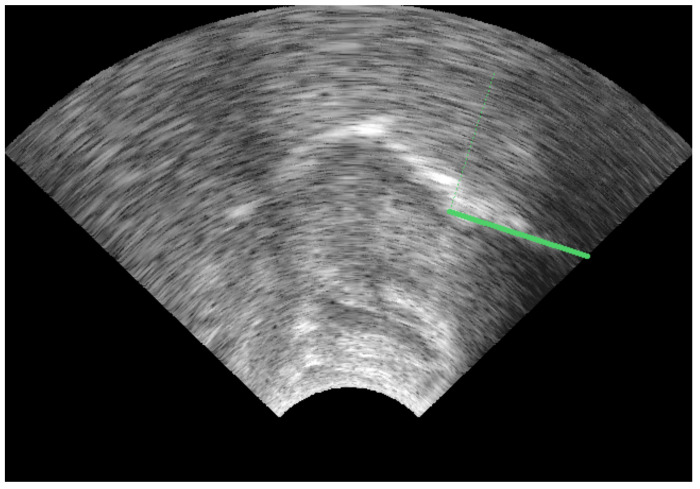 Figure 13