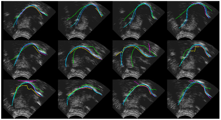 Figure 10