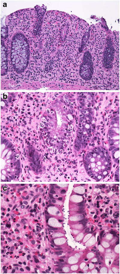 Fig. 11