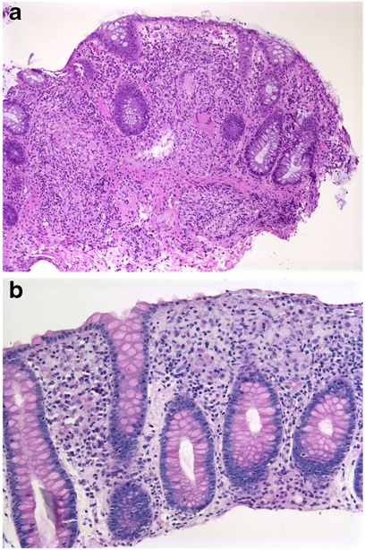 Fig. 10