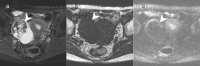 Fig. 11