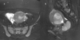 Fig. 14