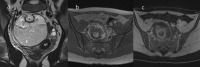 Fig. 18