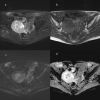 Fig. 12