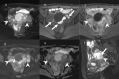 Fig. 16