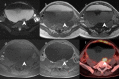Fig. 19