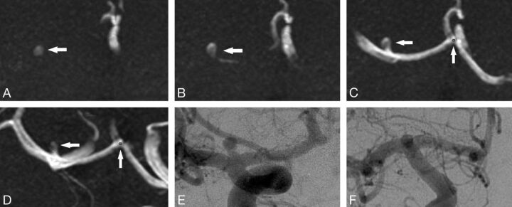 Fig 4.