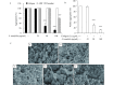 A–C: Washed platelets were pretreated with <italic>S. tenuifolia</italic> extract or vehicle for two minutes in the presence of 1 mmol/L CaCl<sub>2</sub>, and then stimulated with collagen (2.5 μg/mL), or ADP (10 μmol/L) or thrombin (0.1 U/mL) for five minutes. C: Scanning electron microscopy was performed in collagen (2.5 μg/mL) treated platelets. Representative scanning electron microscopy images of platelets treated with (a) Resting (b) Vehicle, (c) 25 μg/mL <italic>S. tenuifolia</italic>, (d) 50 μg/mL <italic>S. tenuifolia</italic>, and (e) 100 μg/mL <italic>S. tenuifolia</italic>. Graph represents the mean±SEM of experiments performed on four independent days with <italic>n</italic>=1 on each day. <sup>***</sup><italic>P</italic><0.001 <italic>vs.</italic> control.