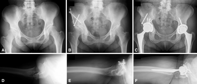 Fig. 1A–F