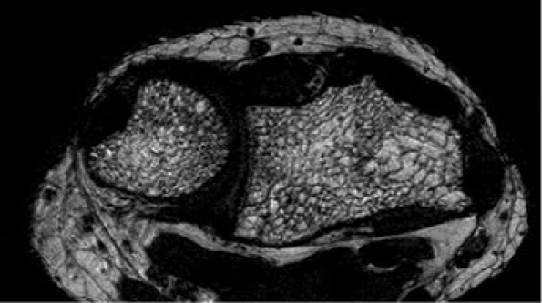 Fig. 5