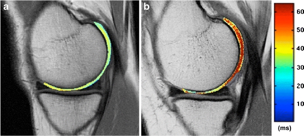 Fig. 12