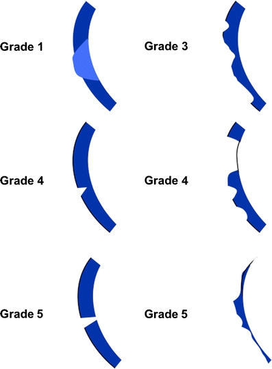 Fig. 9